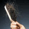 Berikut Ini 8 Tips Menjaga Rambut Agar Tidak Mudah Rontok