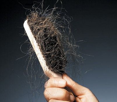 Berikut Ini 8 Tips Menjaga Rambut Agar Tidak Mudah Rontok