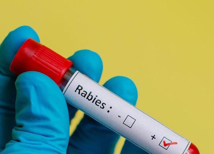 Berapa Lama Penyakit Rabies Bisa Menjangkiti Manusia dan Hewan