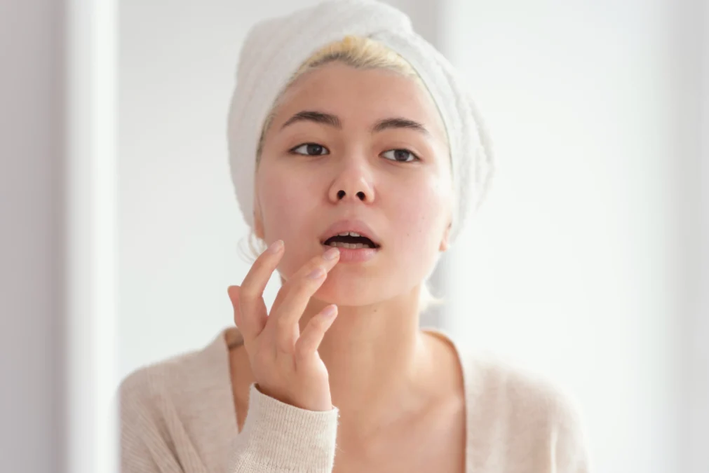 tips mengatasi bibir kering