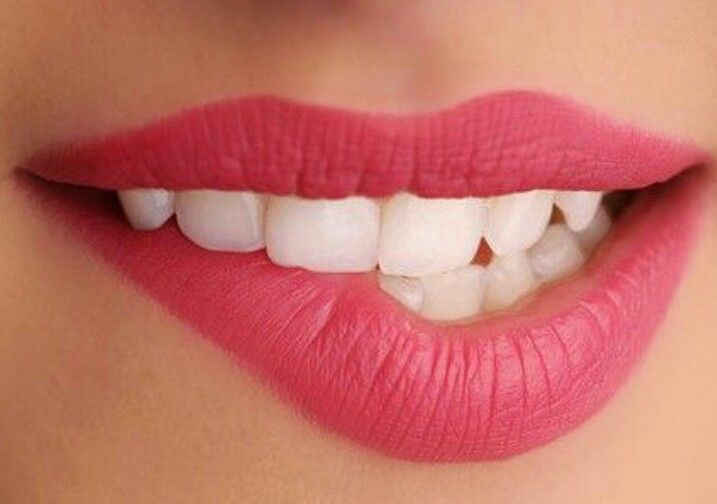 efek buruk dari kebiasaan menggigit bibir