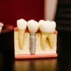 Gigi Kelinci dan Gigi Gingsul Menjadi Fenomena Unik dalam Kesehatan Gigi